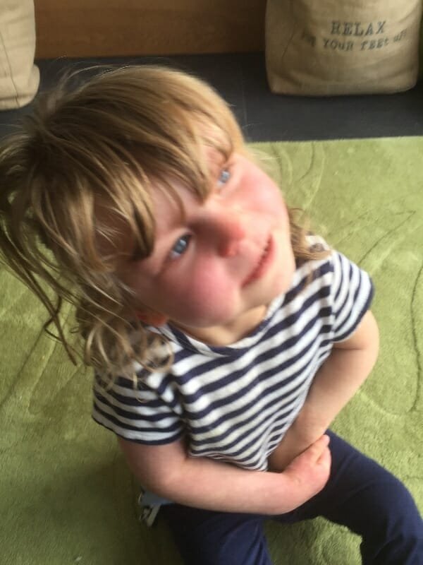 Meet Matilda Callaghan: The Little Girl Covered in Polka Dots! - HuffBreak