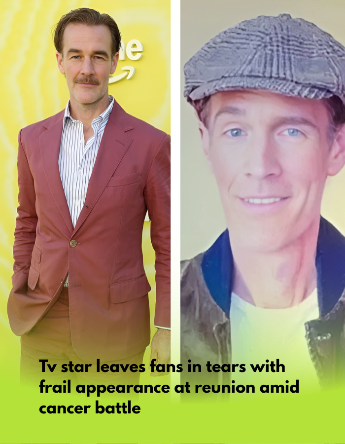 James Van Der Beek shocks fans with very frail appearance in Dawson’s Creek reunion video amid cancer battle James Van Der Beek shocks fans with very frail appearance in Dawson’s Creek reunion video amid cancer battle