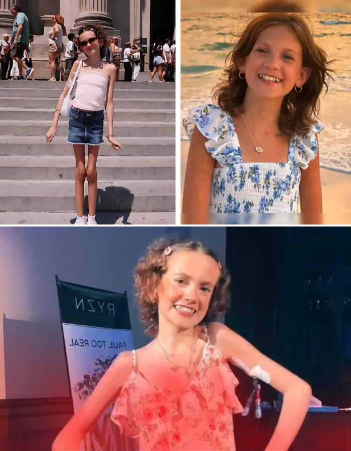 Zuza Beine, 14-year-old influencer who inspired millions by sharing her cancer battle, has died Zuza Beine, 14-year-old influencer who inspired millions by sharing her cancer battle, has died