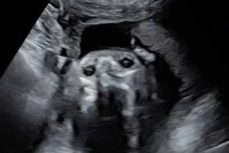 Pregnant Woman Left Shocked After Her Sonogram Images Have ‘Uncanny’ Resemblance to Her Dog Pregnant Woman Left Shocked After Her Sonogram Images Have ‘Uncanny’ Resemblance to Her Dog
